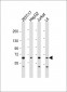 PDP1 Antibody (Center)
